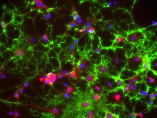 Staining of MOSP, GFAP and DAPI in a neural cell culutre from rat brain